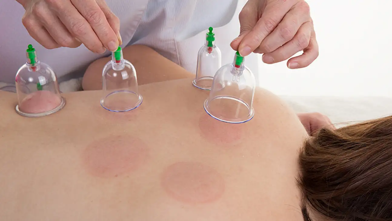 Yeni Hacamat Takvimi 2025: Ocak'ta Hangi Günler Sünnettir